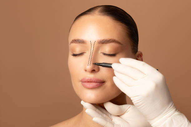 La rhinoplastie est une chirurgie esthétique ou fonctionnelle du nez. Elle permet d’améliorer l’apparence ou la respiration. En effet,