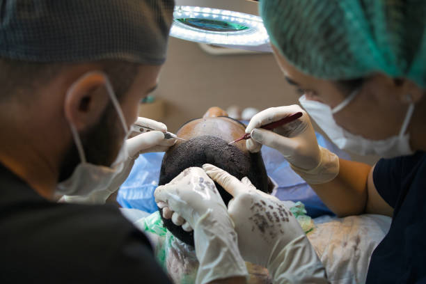 Une greffe de cheveux peut entraîner des effets secondaires juste après l’intervention. En effet, les patients constatent